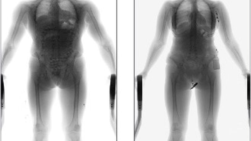 OD Security, the manufacturer for the Full Body Security Scanning System, provides an example of a scanned body image. OD SECURITY NORTH AMERICA