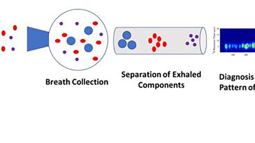 This schematic illustration shows how a disease is identified by the pattern of compounds detected in exhaled breath. Gas chromatography is an analytical technique that separates the chemical constituents of an air sample into components, with the retention time (the amount of time it takes for a given compound to pass through the chromatography column) being an identifying characteristic of each compound. (Courtesy illustration)