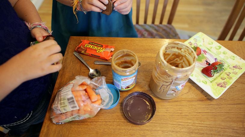 Since she was six years old, Shoshana Blumenfeld, 11, has avoided eating carrots, several kinds of fruits, tree nuts, and peanuts because of a misdiagnosed peanut allergy. Now that a new test has revealed she is only allergic to birch pollen, Blumenfeld can eat almost anything she wants. (Photo by Tamir Kalifa for The Boston Globe via Getty Images)