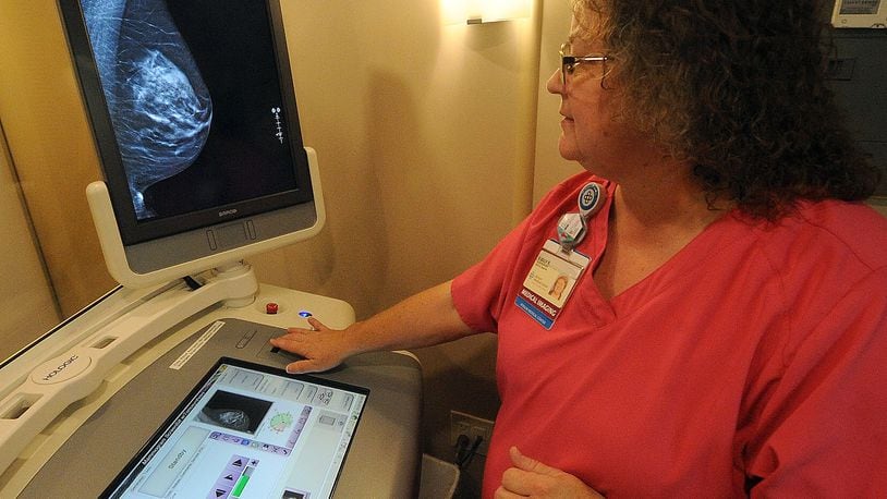 Shelly Robinson, mammographer for Premier Health mobile mammography coach, pulls up a 3-D scan. Breast cancer is the leading cause of cancer deaths in women under 50 years old. MARSHALL GORBY\STAFF