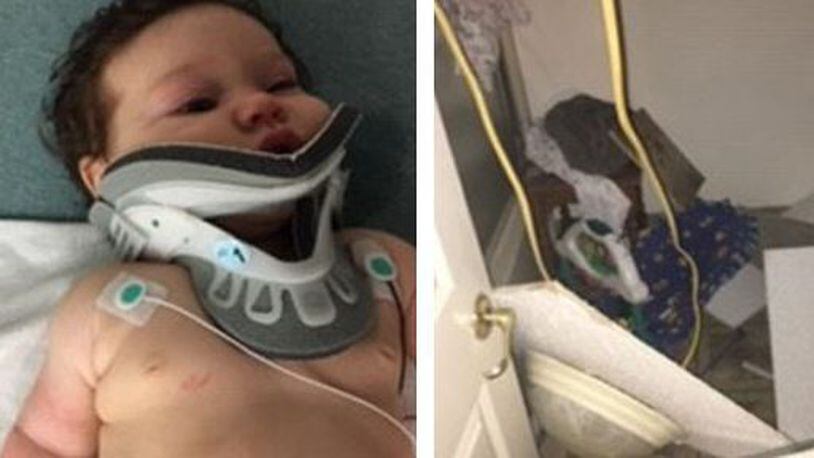 An infant is in a neck brace after part of an apartment ceiling collapsed on top of her.