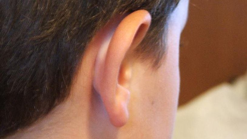 Child's ear (stock photo). (Photo credit: ronnieb / Morguefile.com)