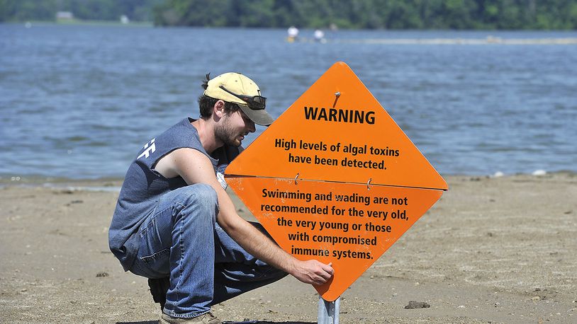 Andrew Headlee, a maintenance worker at Kiser Lake State Park, posts a sign on the beach warning people of the toxic algae in the water in 2015. State officials issued another public health advisory on Friday for the lake in Champaign County, recommending that visitors take caution when going to the lake. Bill Lackey/Staff file photo