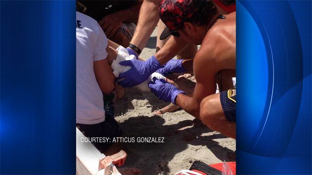 Boy bitten by shark in Cocoa Beach