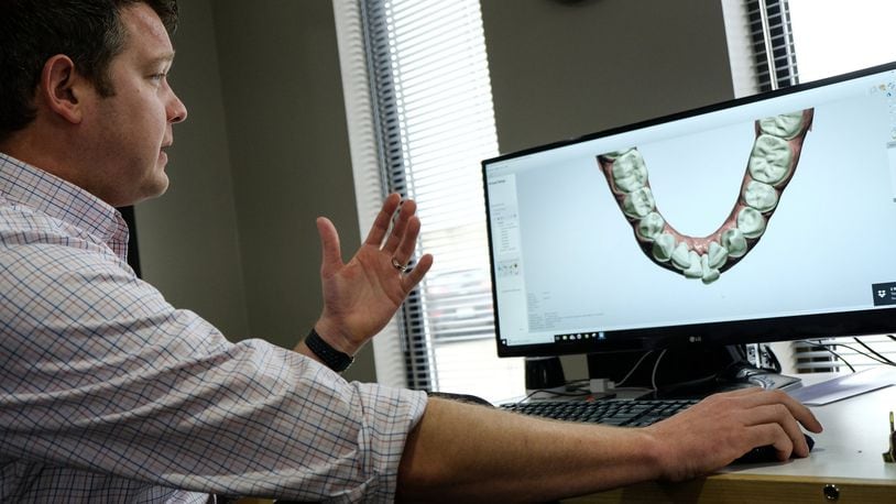 Motor City Lab Works partner Christian Groth describes the use of digital scans that are used to make molds of teeth to be used for retainers and aligners with digital printers on February 1, 2018, at the company in Birmingham, Mich. (Ryan Garza/Detroit Free Press/TNS)