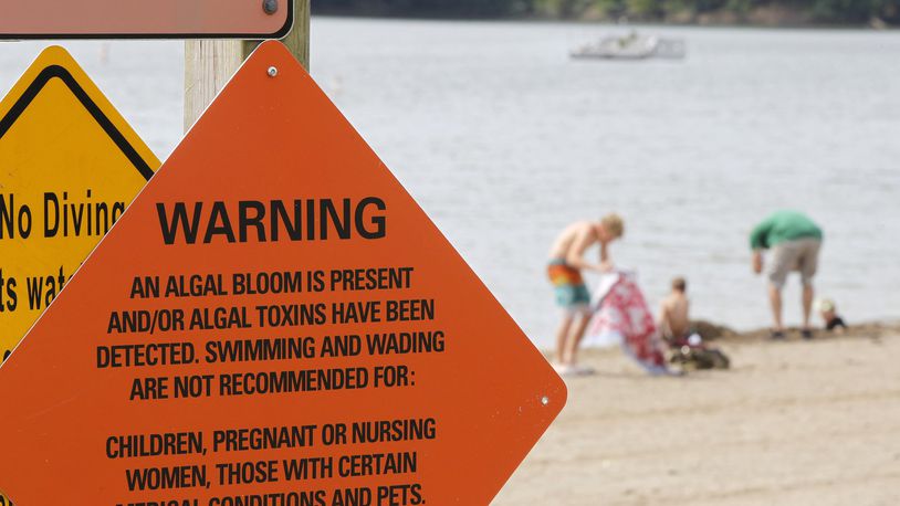Signs have been posted along the beach at Caesar Creek Lake warning of an algal bloom in the water. TY GREENLEES / STAFF
