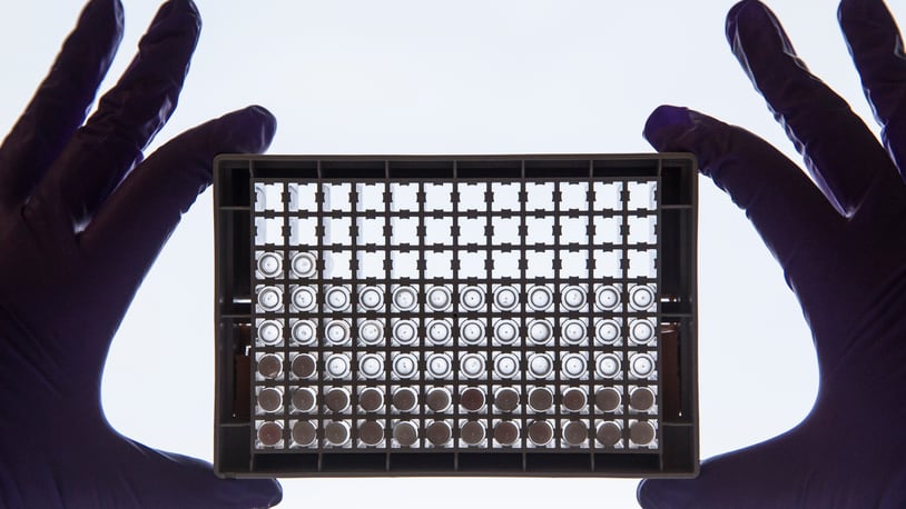A scientist examining cells in a 96-well plate. These plates allow scientists to look at lots of cells at the same time and directly compare cells that have or have not been treated with a drug.