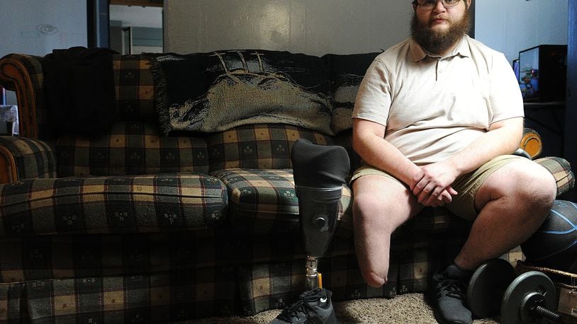 Evan Hopkins was injured in a head-on car crash in August 2017 while traveling to the Warren County Career Center for school. He broke multiple bones, including his ankle. A jury found a doctor was negligent in the care and treatment of Hopkins and awarded him $2.92 million. MARSHALL GORBY\STAFF