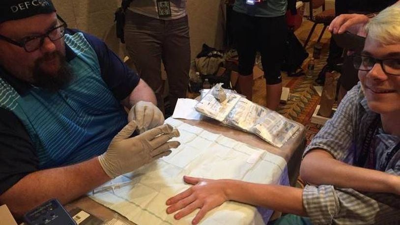 Doug Copeland, left, prepares to implant a microchip in the hand of Kyle Spiers at a workshop at the DefCon 2017 convention in Las Vegas on July 28, 2017. Hackers who implant microchips are known as “grinders,” a term taken from a comic book. (Tim Johnson/McClatchy/TNS)