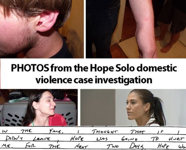 Hope Solo domestic violence investigation