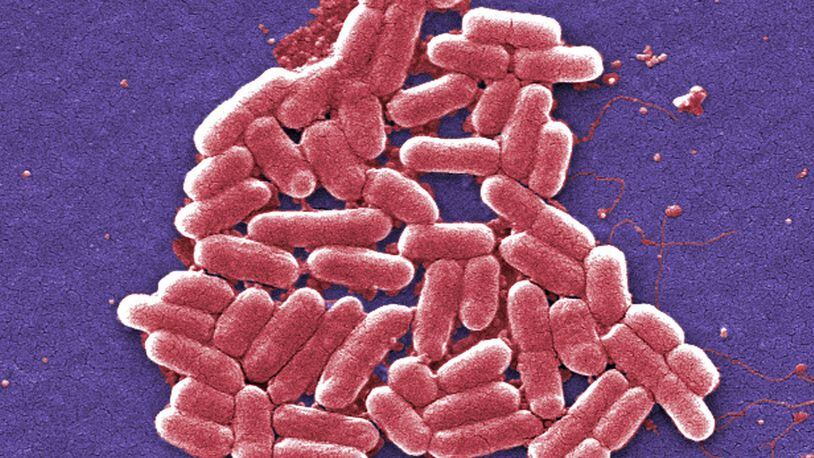 This colorized scanning electron micrograph image made available by the Centers for Disease Control and Prevention shows a strain of the E. coli bacteria. (Janice Carr/CDC via AP)