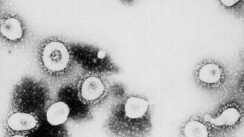 This undated handout photo from the Centers for Disease Control and Prevention (CDC) shows a microscopic view of the Coronavirus at the CDC in Atlanta, Georgia.