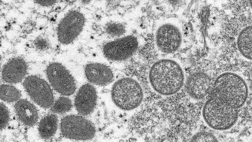 FILE - This 2003 electron microscope image made available by the Centers for Disease Control and Prevention shows mature, oval-shaped monkeypox virions, left, and spherical immature virions, right, obtained from a sample of human skin associated with the 2003 prairie dog outbreak. (Cynthia S. Goldsmith, Russell Regner/CDC via AP, File)