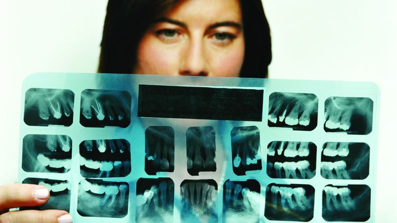 The majority of dental injuries are minor and include slightly chipped teeth or bleeding gums. However, some can be complex and involve multiple teeth and even bone. If there is bleeding from the tooth’s center, an evaluation and treatment by a dentist are needed as soon as possible. METRO NEWS SERVICE PHOTO