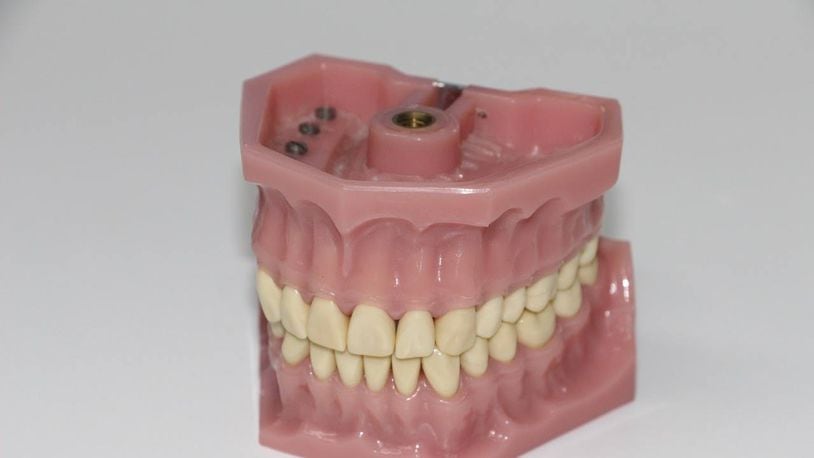 A Florida woman's dentures were knocked out of her mouth when she was hit by a TV remote, according to deputies.
