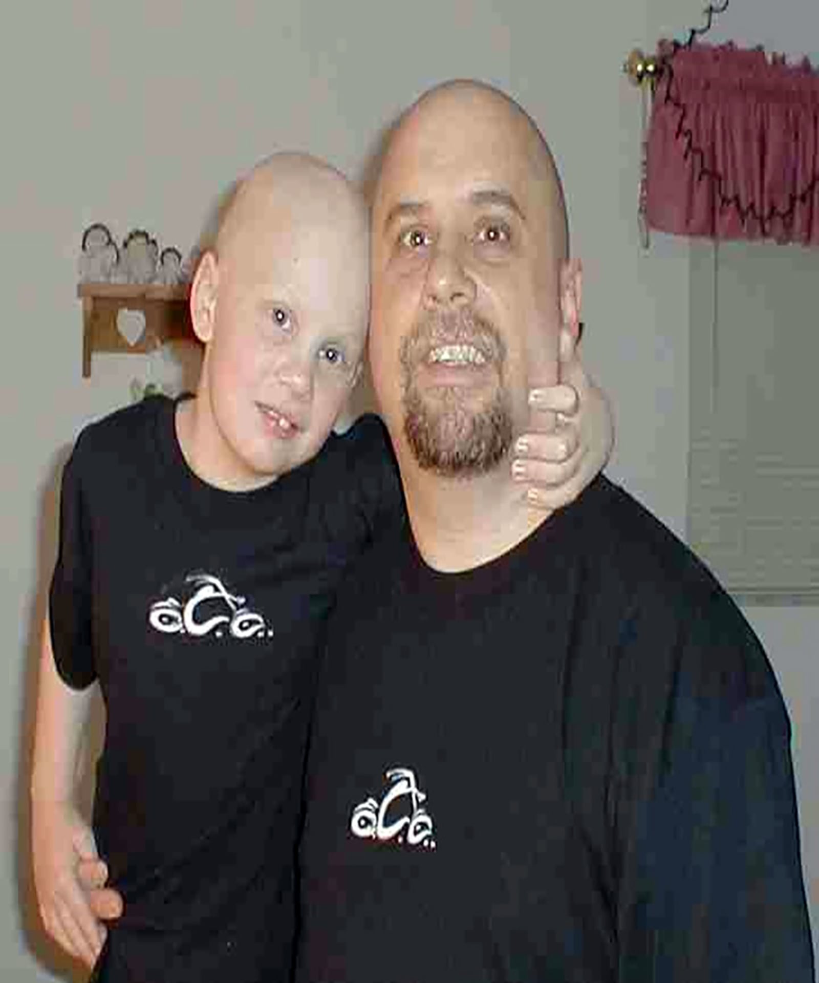 Brenner (Left) with his Dad, Tom Brenner, who moved with his son to Columbus so he could be with him during his stem cell and bone marrow transplants. 
