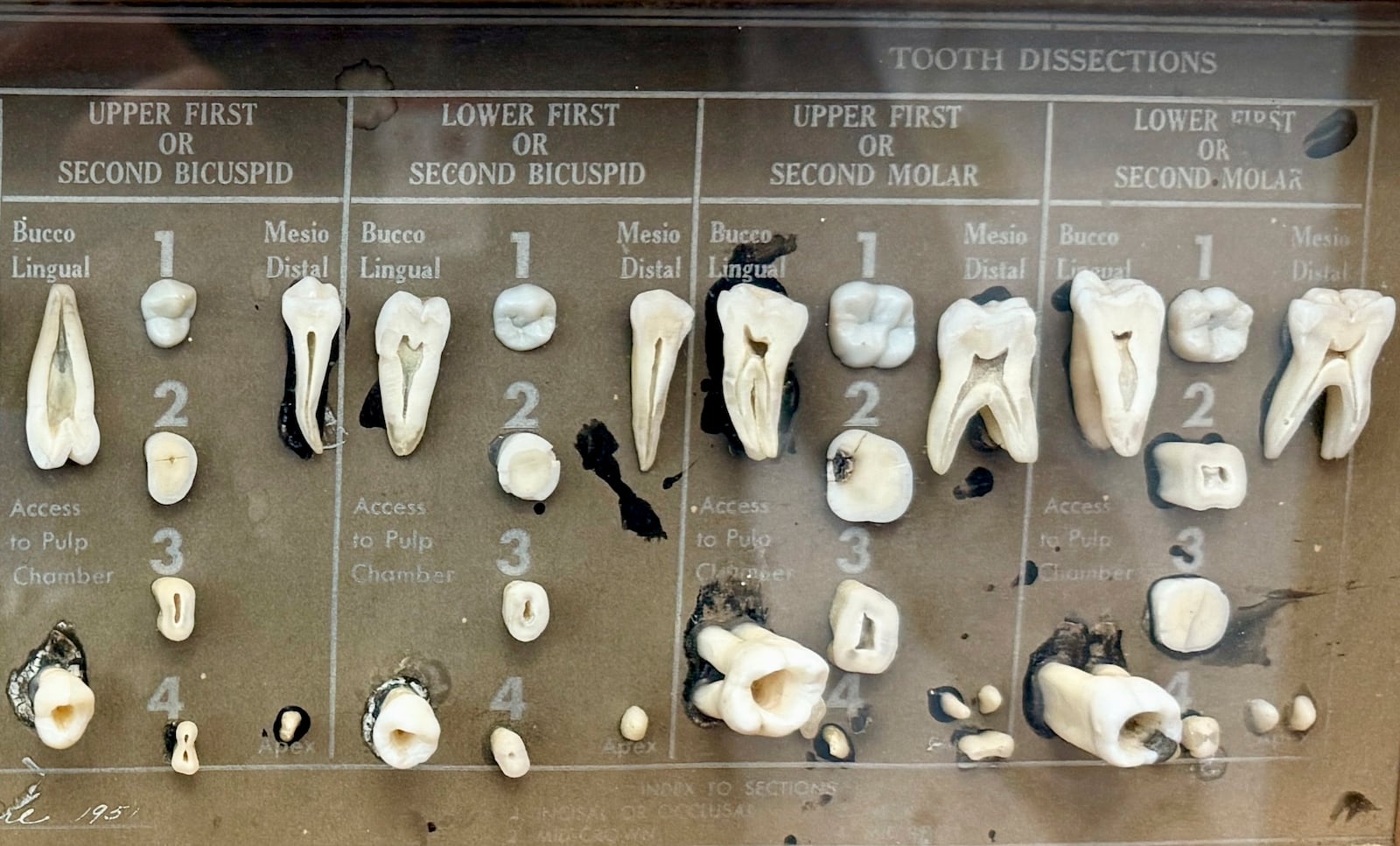 Dissected human teeth are displayed in the office of dentist Dr. James Bekker, April 30, 2025, in Salt Lake City, Utah. (AP Photo/Hannah Schoenbaum)