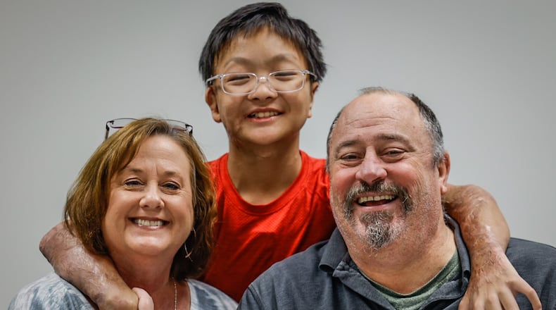 Julian and Angie Farley, from Washington Township near Centerville, are adopting Xin Liang from China. Liang's Chinese parents believe Xin would have a better life in the United States after Xin was severely burned in his village. JIM NOELKER/STAFF