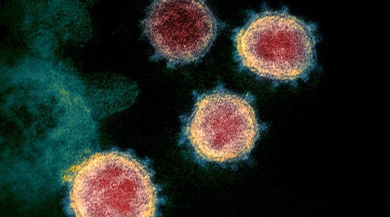 This undated electron microscope image made available by the U.S. National Institutes of Health in February 2020 shows the virus that causes COVID-19. The sample was isolated from a patient in the U.S. Excitement about treating the new coronavirus with malaria drugs is raising hopes, but the evidence that they may help is thin. (NIAID-RML via AP)
