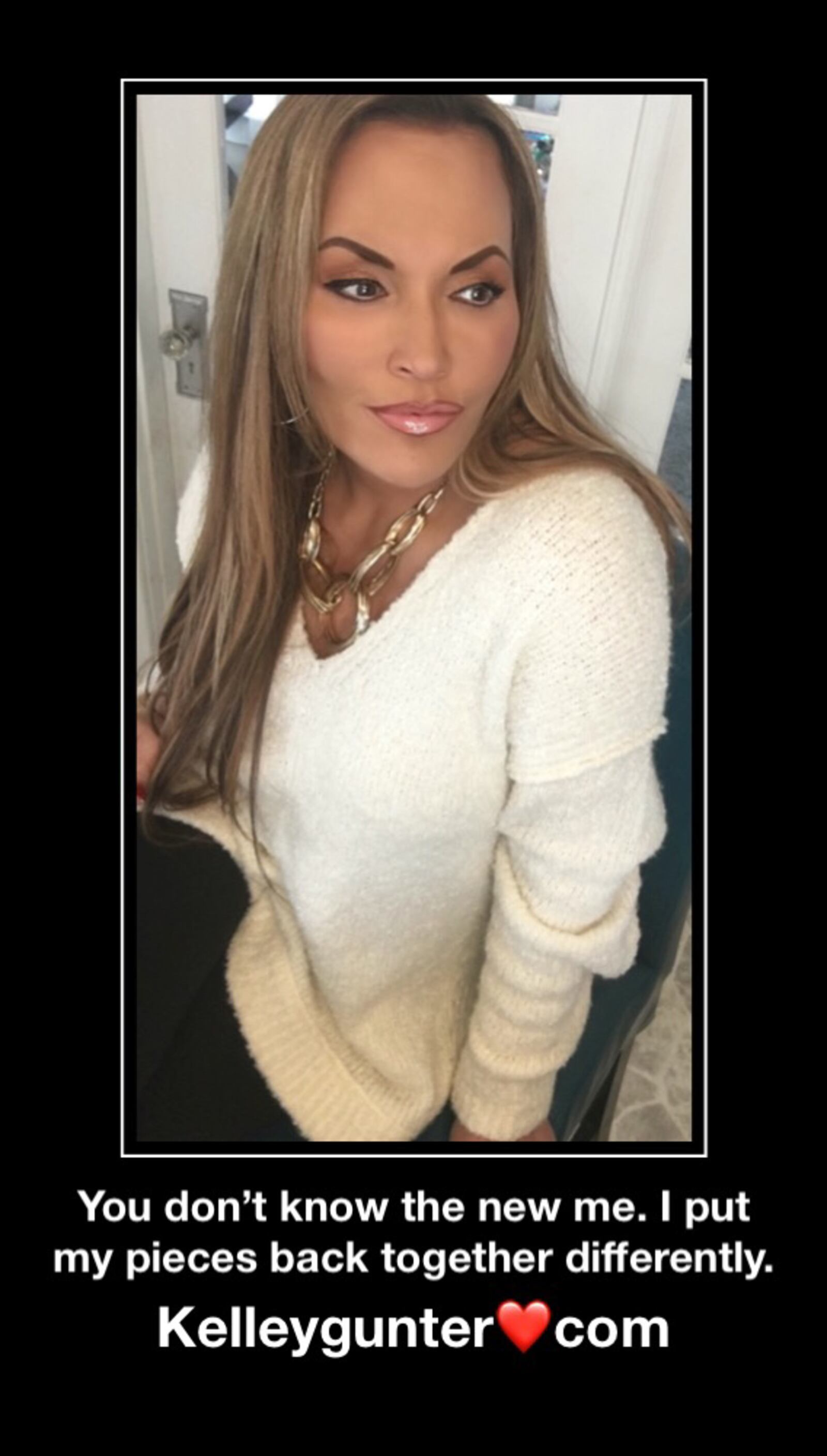 Troy resident Kelley Gunter, the author of the new book "You Have Such a Pretty Face," loss 243 with the help of weight loss surgery in 2002. She says true transformation came when he sought help for her destructive behavior.  She lives with her son Alec and three Rottweilers.