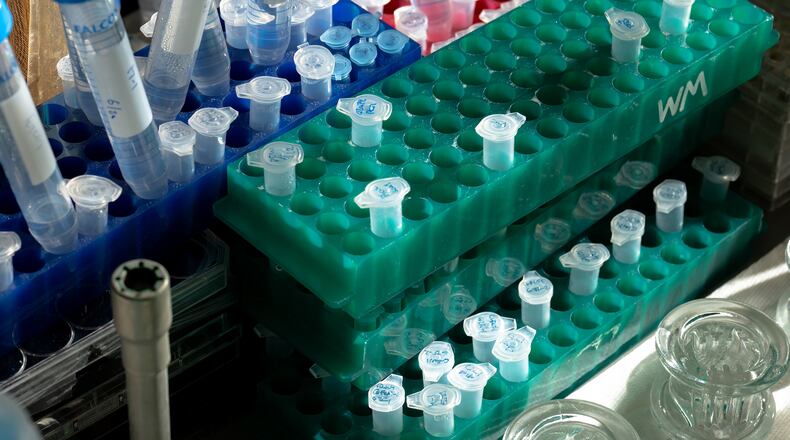 Lab equipment used by Ashley Albright, a postdoctoral researcher in molecular and cell biology at the University of California-San Francisco who lost all but half a year of a five-year, $1 million career transition grant, in San Francisco, June 26, 2025. The National Institutes of Health has terminated hundreds of diversity grants awarded to young researchers, many of whom come from the very places that supported President Donald Trump. (Mike Kai Chen/The New York Times)