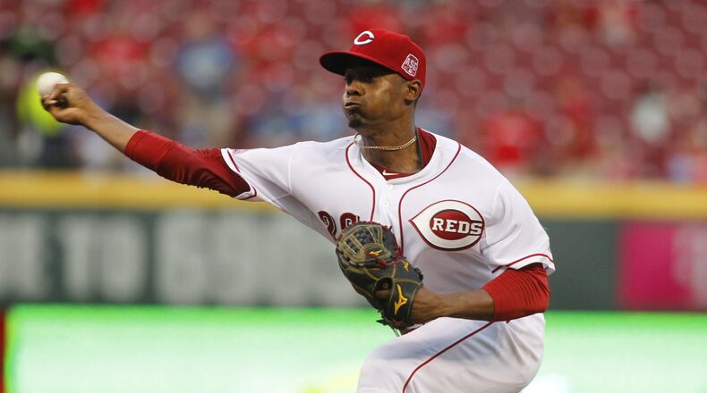 Reds pitcher Raisel Iglesias got some good news when results of an MRI showed just a contusion and no structural damage to his right elbow Wednesday. File