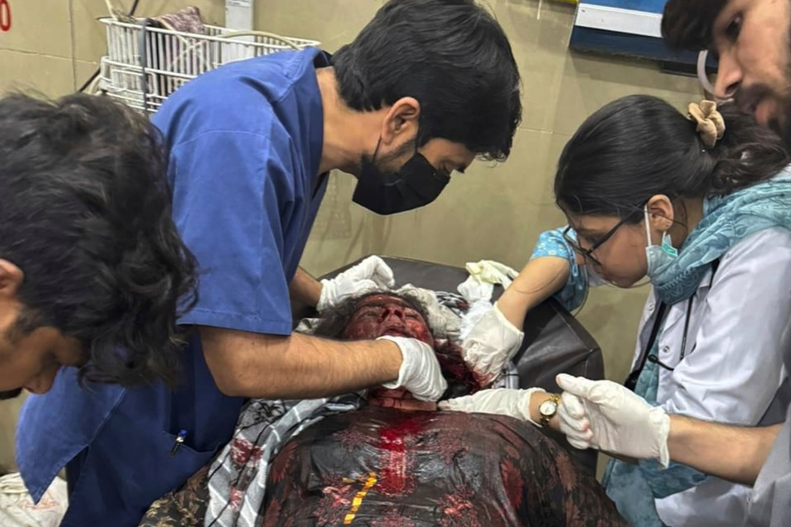 In this photo released by the Inter Services Public Relations, a woman injured in a suspected Indian missile attack, receives treatment at a hospital in Bahawalpur, Pakistan, May 7, 2025. (Inter Services Public Relations via AP)
