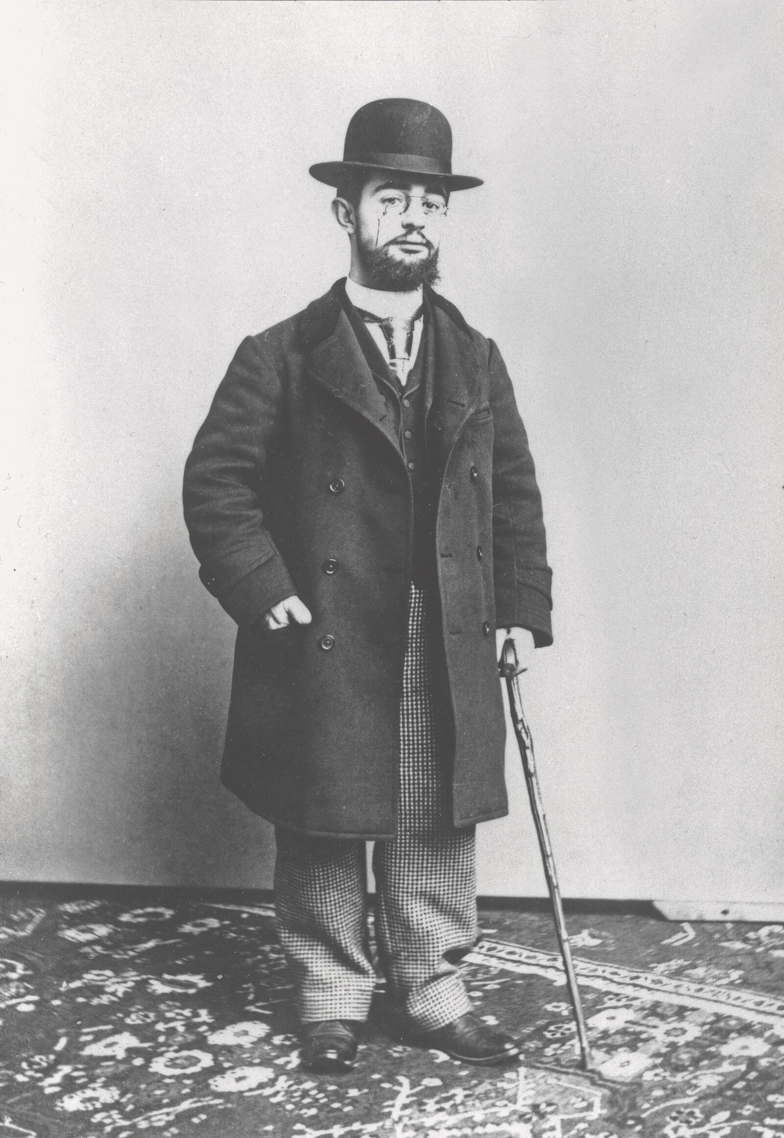 Henri de Toulouse-Lautrec, seen in this 1894 photograph, was born into a wealthy family. But he chose instead to live among bohemian folks in the Montmartre district of Paris. (All works and images are courtesy of Firos Collection. Single-source exhibition provided by PAN Art Connections, with support of The Museum Box.)