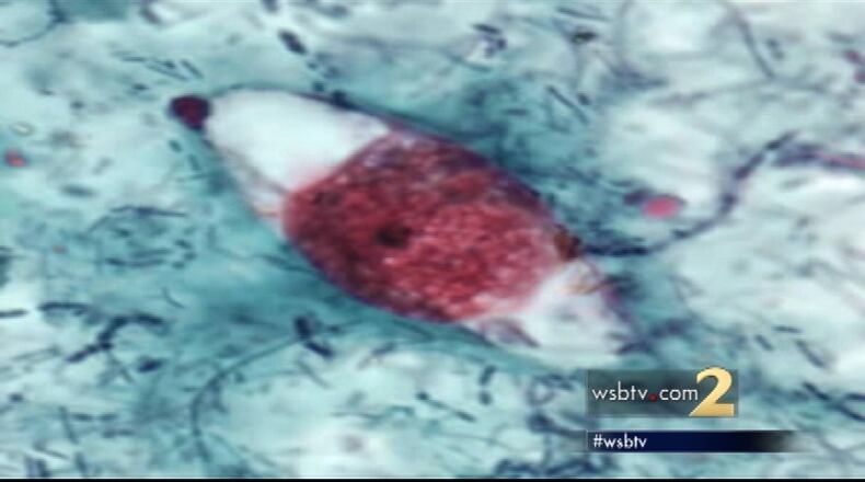 Gelber says her doctor told her she could be suffering because of a parasite called Cystoisosporiasis.