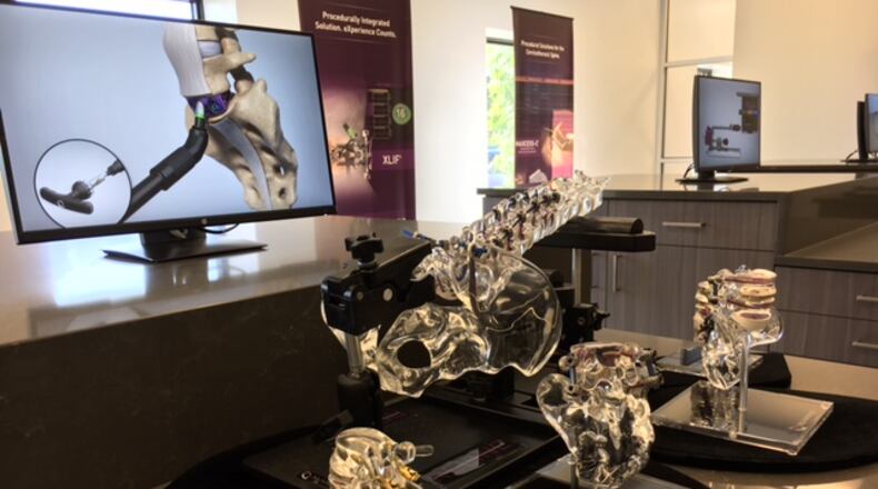 Examples of NuVasive handiwork in the lobby of the company’s West Carrollton facility. THOMAS GNAU/STAFF