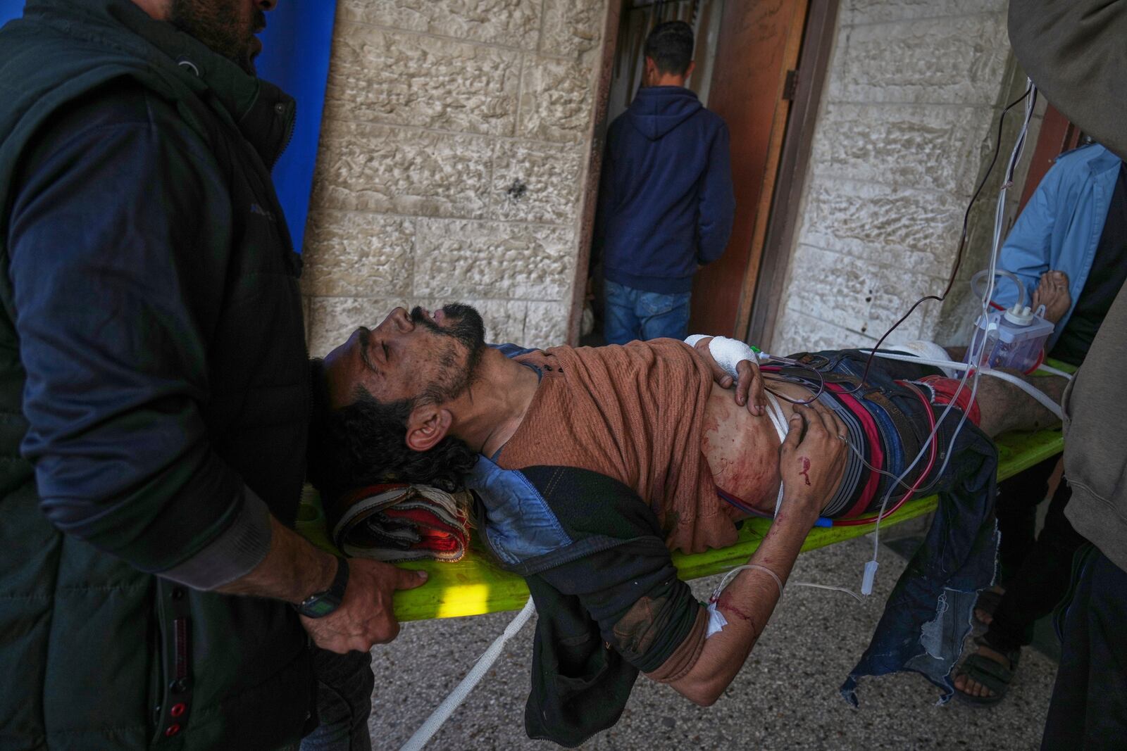 AnPalestinian injured during Israeli army strikes in nearby Zawaida and Nuseirat camp is taken into the hospital in Deir al-Balah, Gaza Strip, Wednesday, March 26, 2025. (AP Photo/Abdel Kareem Hana)