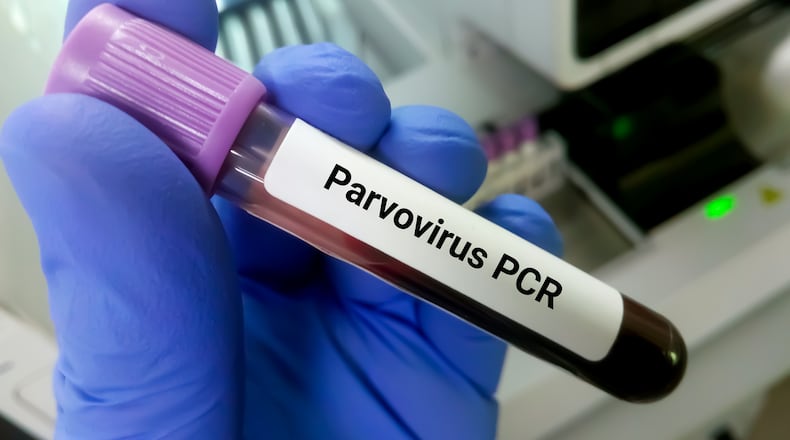A blood sample is needed to test animals for Parvovirus. A local clinic says there has been an uptick in cases in 2025. ISTOCK