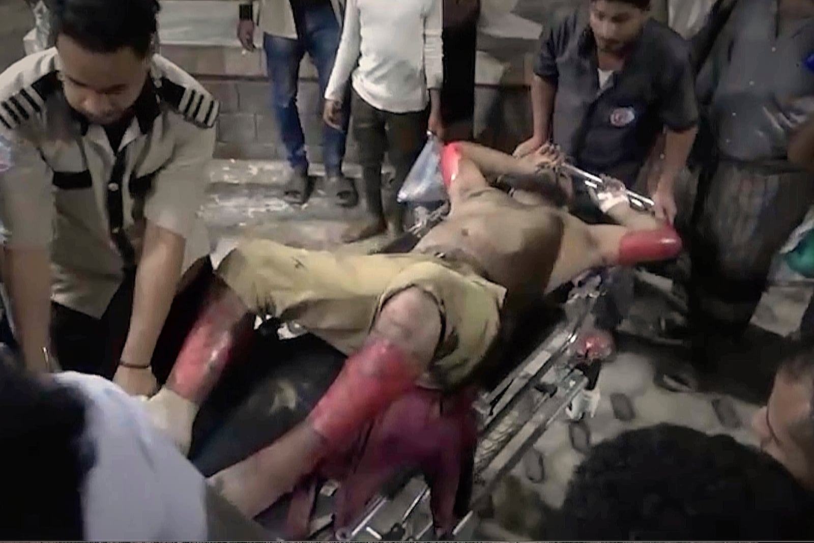 This photo taken from video released by Al Masirah TV channel shows medics carrying a wounded man into the hospital after U.S. airstrikes targeted the Ras Isa oil port held by Yemen's Houthi rebels in Hodeida, Yemen, Friday, April 18, 2025.( Al Masirah TV via AP)