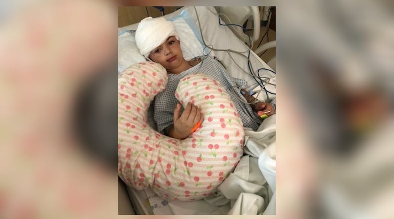 Savannah Coleman sustained head injuries from a dog attack in Miami Twp. CONTRIBUTED