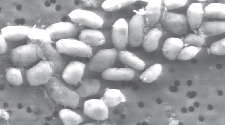 'If it's for real, it's groundbreaking,' says one University of Houston biologist of the discovery of bacterial strain GFAJ-1, depicted in a scanning electron micrograph image.