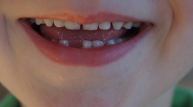 A Michigan girl who lost her tooth persuaded her mother to make a mask so the tooth fairy would be safe.