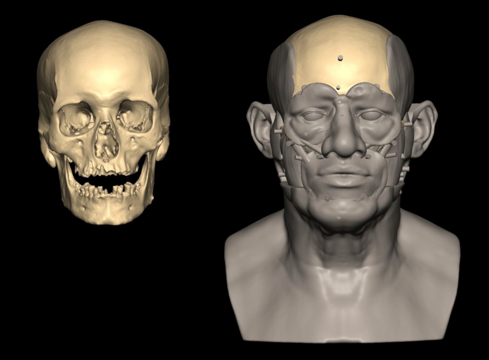 This image provided by researchers shows a facial reconstruction of a man radiocarbon dated to around 2855–2570 cal BCE found in Nuwayrat, Egypt. (Caroline Wilkinson/Liverpool John Moores University via AP)