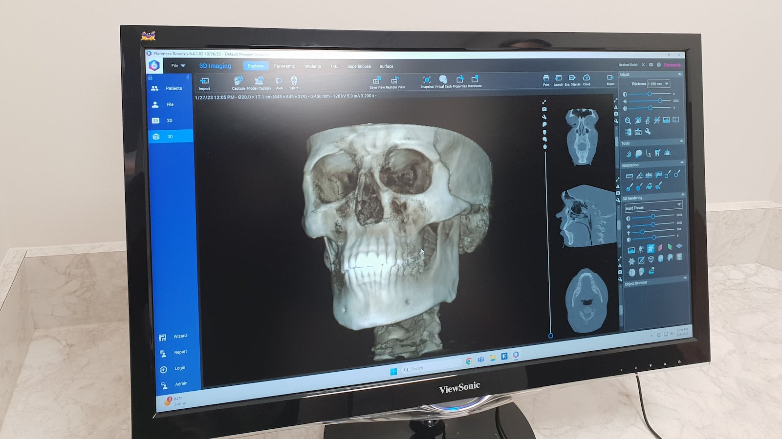 An example of the new imaging equipment at Springfield Gentle Smile, located at 2540 N. Limestone St. in Springfield. CONTRIBUTED