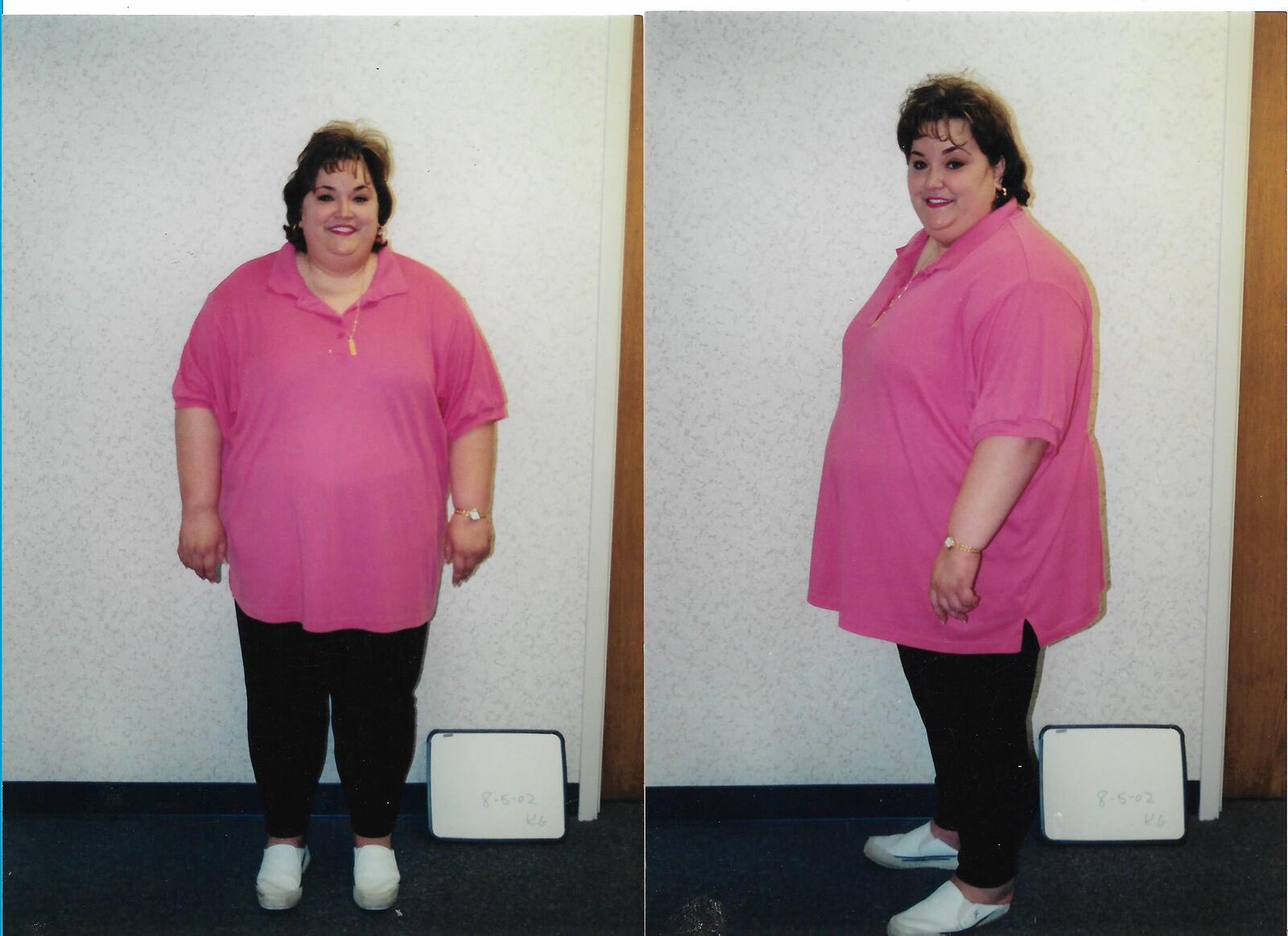 Troy resident Kelley Gunter, the author of the new book "You Have Such a Pretty Face," loss 243 with the help of weight loss surgery in 2002. She says true transformation came when he sought help for her destructive behavior.  She lives with her son Alec and three Rottweilers.
