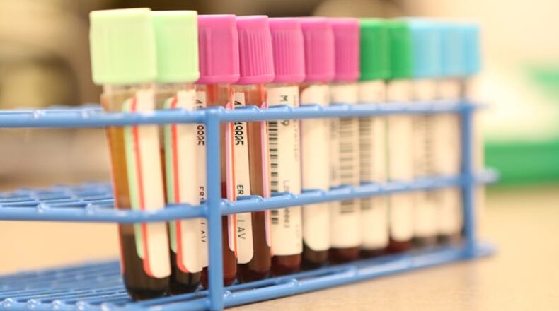 Hepatitis C cases have increased. CONTRIBUTED