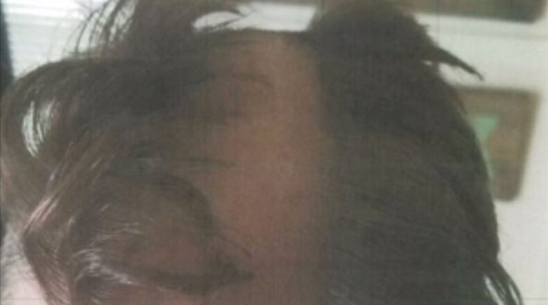 A Wisconsin barber had his clippers taken away by police after leaving a customer bloody and missing a large portion of his hair.