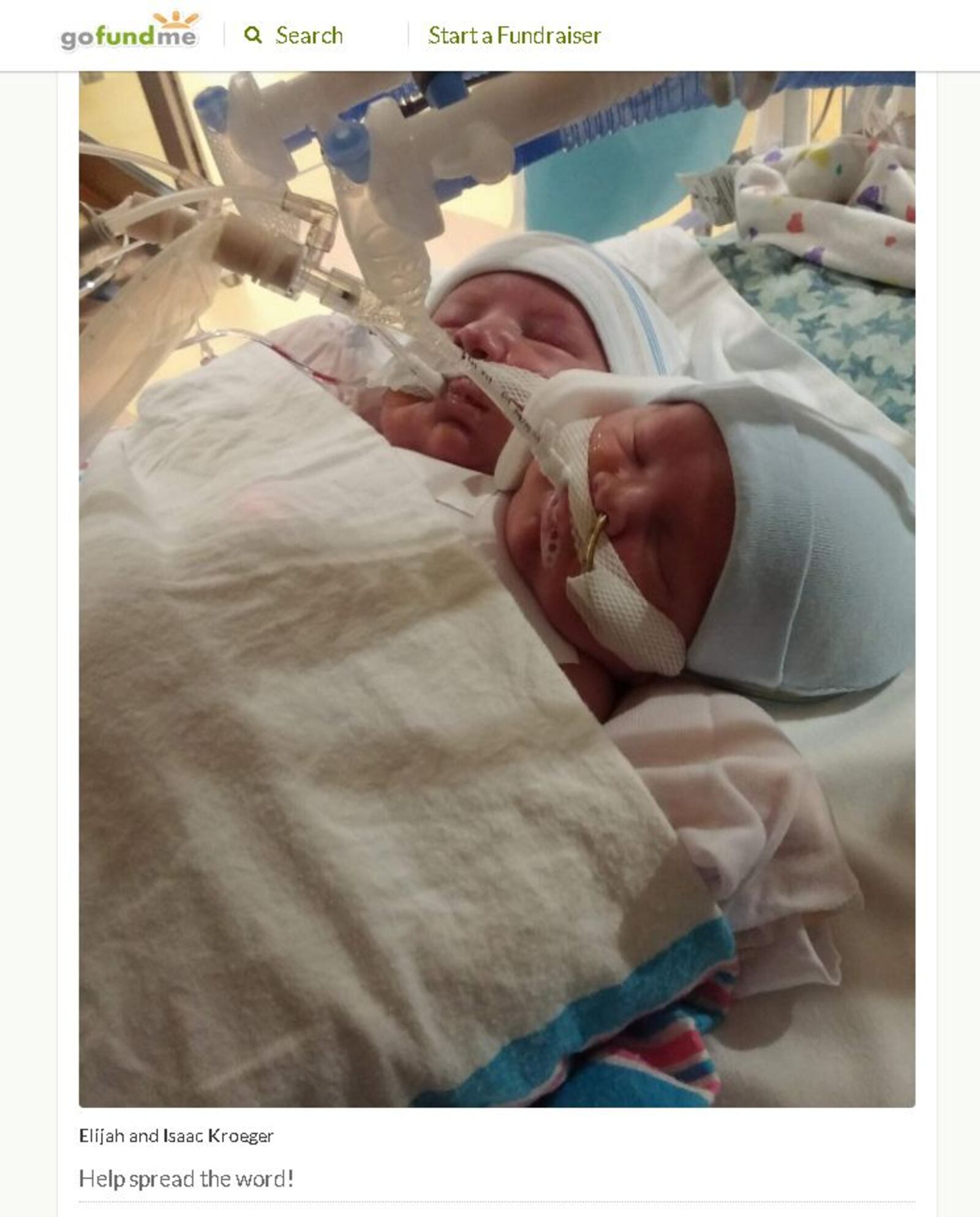 Conjoined twins Elijah and Isaac Kroeger, contributed from Go Fund Me
