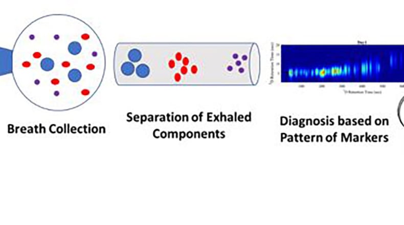This schematic illustration shows how a disease is identified by the pattern of compounds detected in exhaled breath. Gas chromatography is an analytical technique that separates the chemical constituents of an air sample into components, with the retention time (the amount of time it takes for a given compound to pass through the chromatography column) being an identifying characteristic of each compound. (Courtesy illustration)