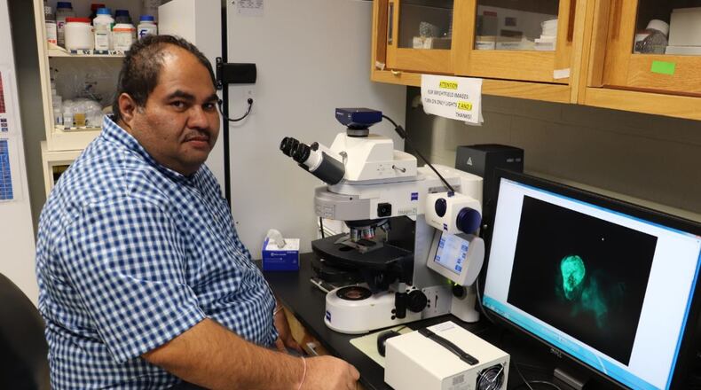 University of Dayton biologist Amit Singh is studying early eye development in fruit flies under a grant from the National Institutes of Health. CONTRIBUTED