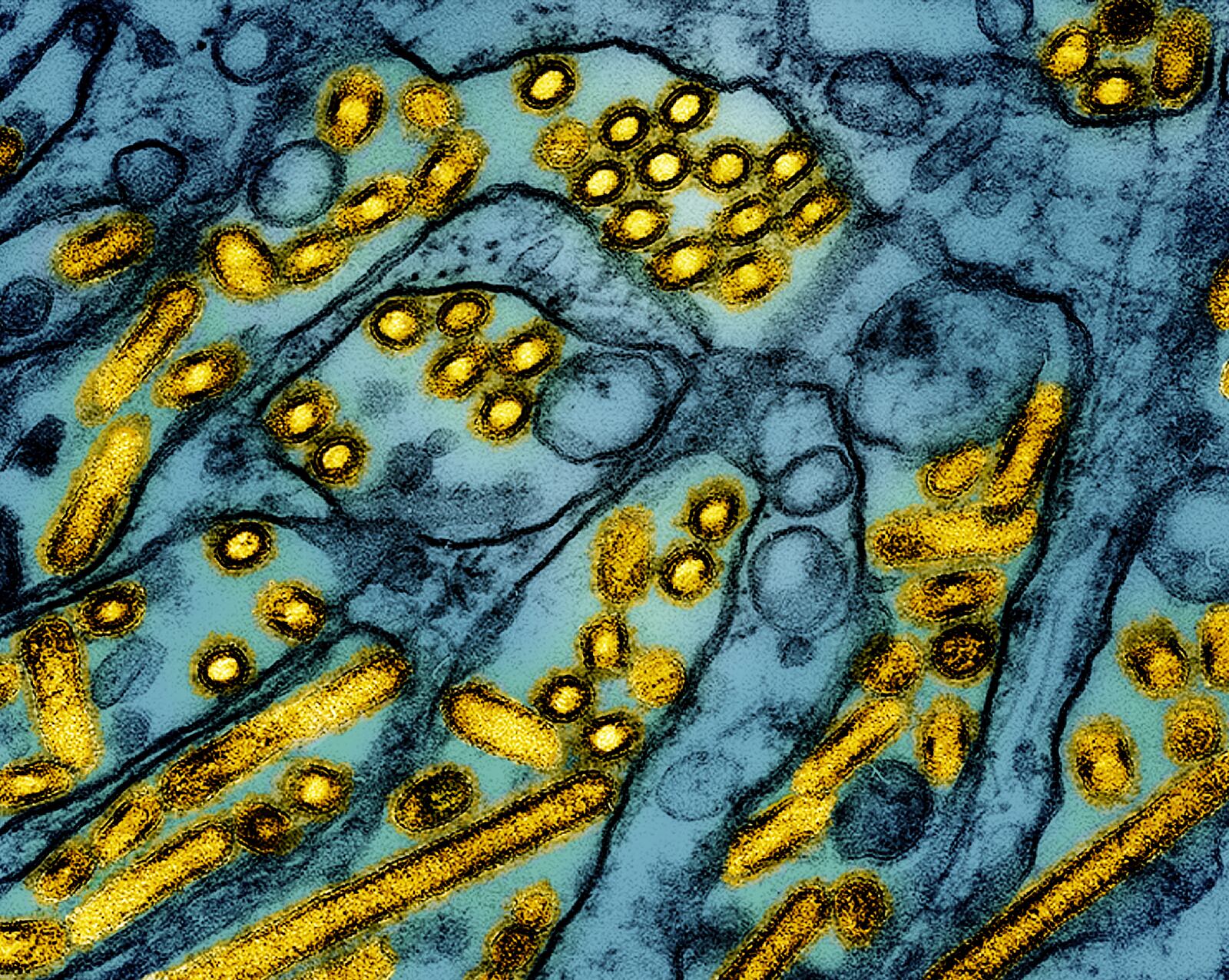 Ohio leads country in chicken flu instances amongst industrial poultry operations