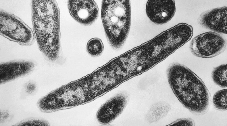 FILE - This 1978 electron microscope image made available by the Centers for Disease Control and Prevention shows Legionella pneumophila bacteria which are responsible for causing the pneumonic disease Legionnaires' disease. Poland's internal security officers were searching for the source of a deadly outbreak of Legionnaires' disease which has killed seven people and infected more than 100 others in the strategic city of Rzeszow, near the border with Ukraine, authorities said Friday Aug. 25, 2023. (Francis Chandler/CDC via AP, File)