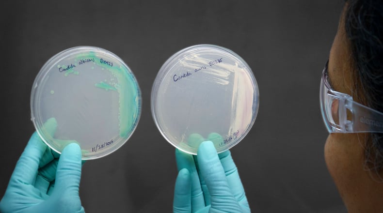An undated photo provided by the Centers for Disease Control and Prevention shows a cultured Candida auris, right, and cultured Candida alibicans. The World Health Organization has released a ranking of fungi that threaten human health in its most ambitious effort to draw attention to a constellation of pathogens that are largely overlooked, even as they have become increasingly widespread, resistant to treatment and deadly. (Centers for Disease Control and Prevention via The New York Times) — NO SALES; FOR EDITORIAL USE ONLY —