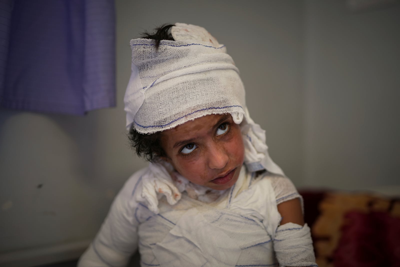 Hamza Abu Shabab, 7, sits in bed with third-degree burns caused when, frightened by an Israeli airstrike, he spilled a hot plate of rice and lentils on himself in the family's tent in southern Gaza last month, at Nasser hospital in Khan Younis, Gaza Strip, Sunday, May 4, 2025.(AP Photo/Abdel Kareem Hana)