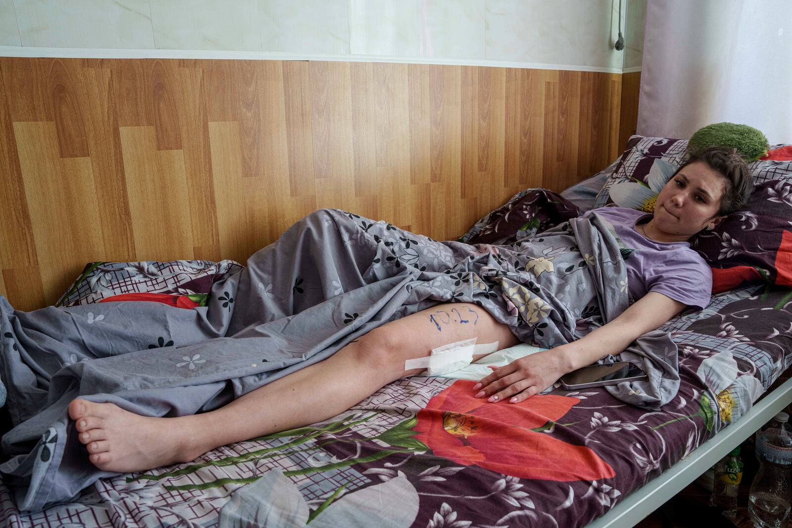 Asia Pohorila, 20, injured in a deadly Palm Sunday Russian attack on Sumy on April 13, lies on a bed at a hospital in Sumy, Ukraine, Tuesday, April 15, 2025. (AP Photo/Evgeniy Maloletka)
