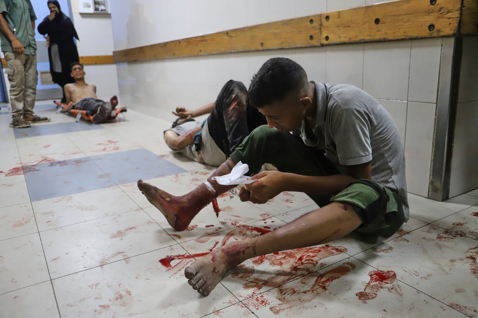A Palestinian man who was injured during a food distribution at a center run by the Gaza Humanitarian Foundation, a U.S.-backed organization approved by Israel, waits for treatment on the floor of Nasser Hospital in Khan Younis, southern Gaza Strip, Saturday, July 19, 2025. (AP Photo/Mariam Dagga)
